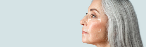 Aging Skin