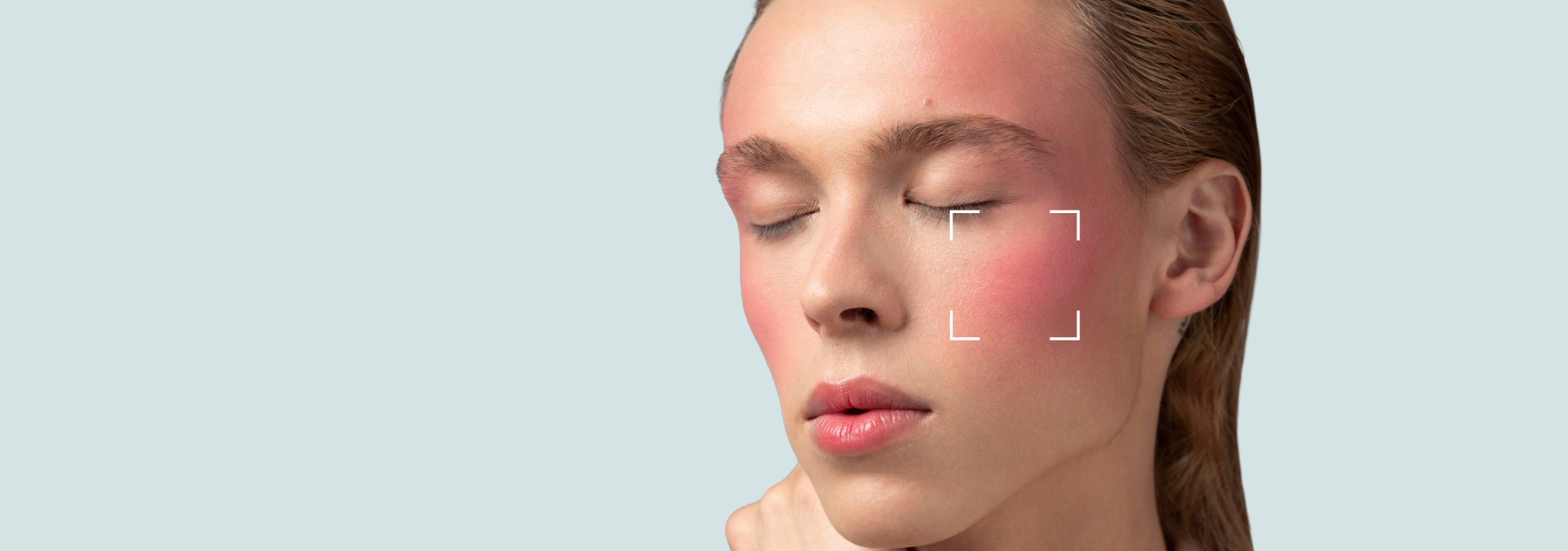 Sensitive Skin