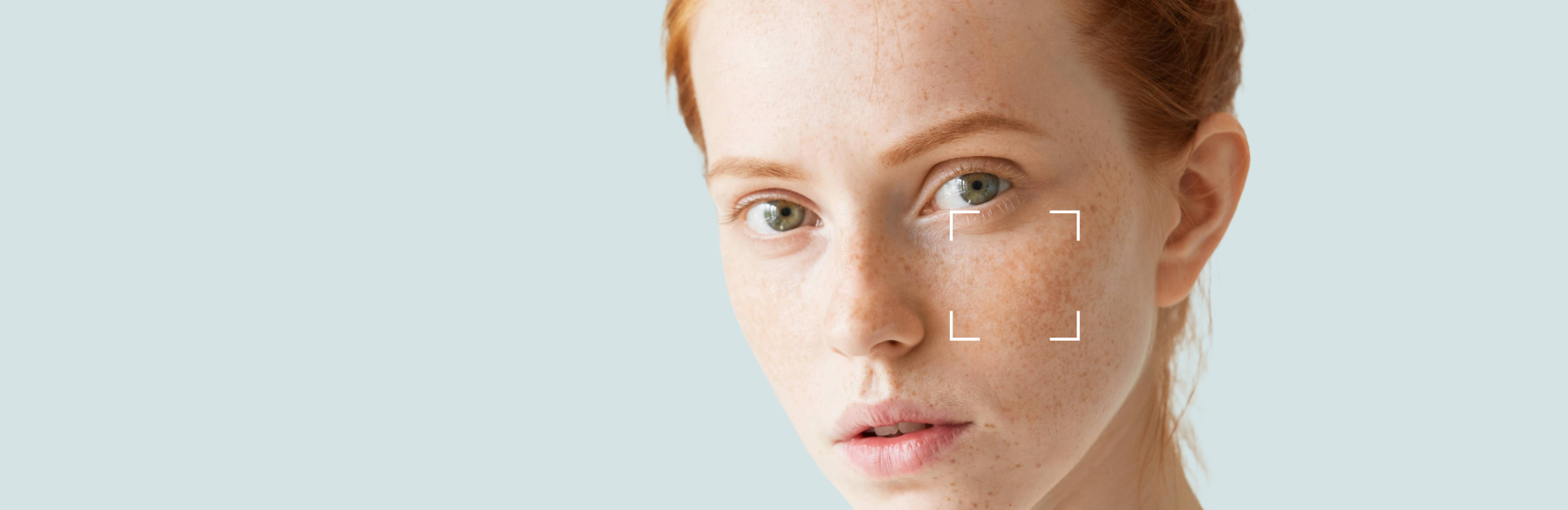 Dry and Dehydrated Skin