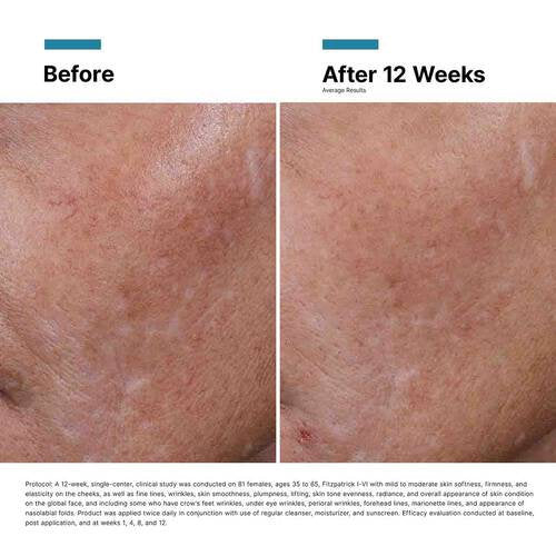 Hyaluronic Acid (HA) Intensifier Multi-Glycan