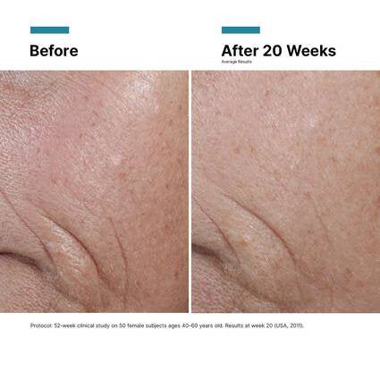 C E Ferulic