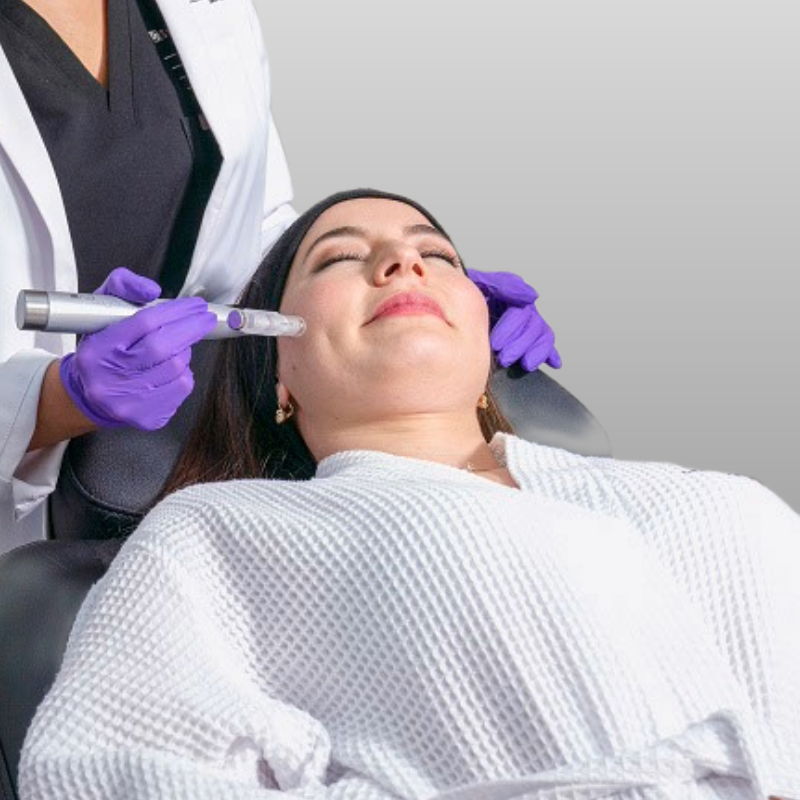 Microneedling