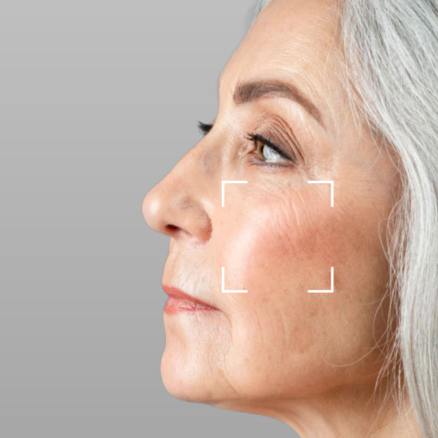 Aging
