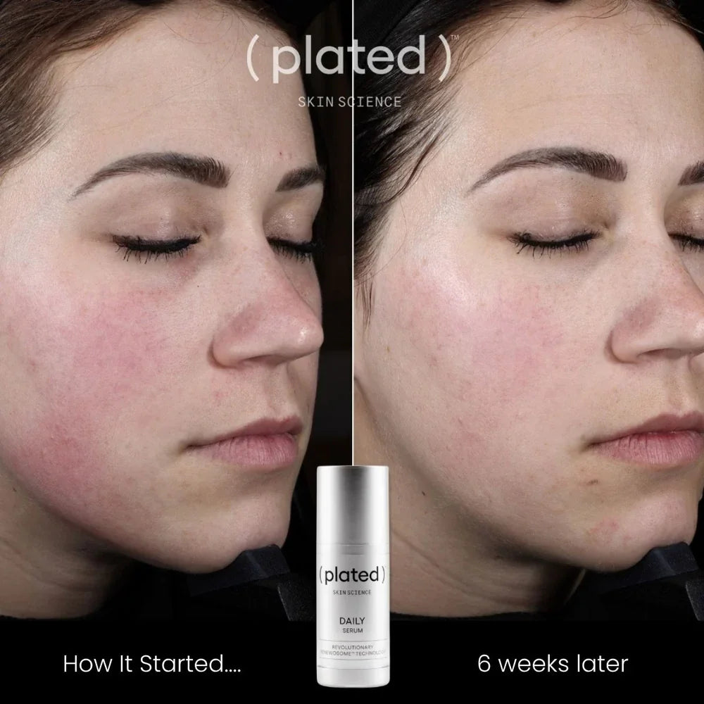 Daily Serum - 1 oz
