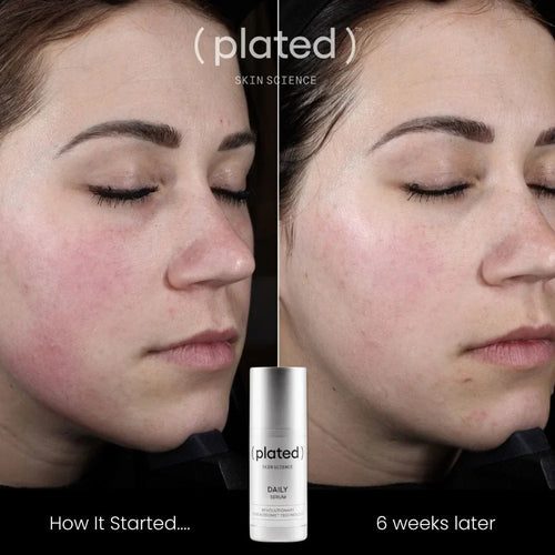 Daily Serum - 1 oz