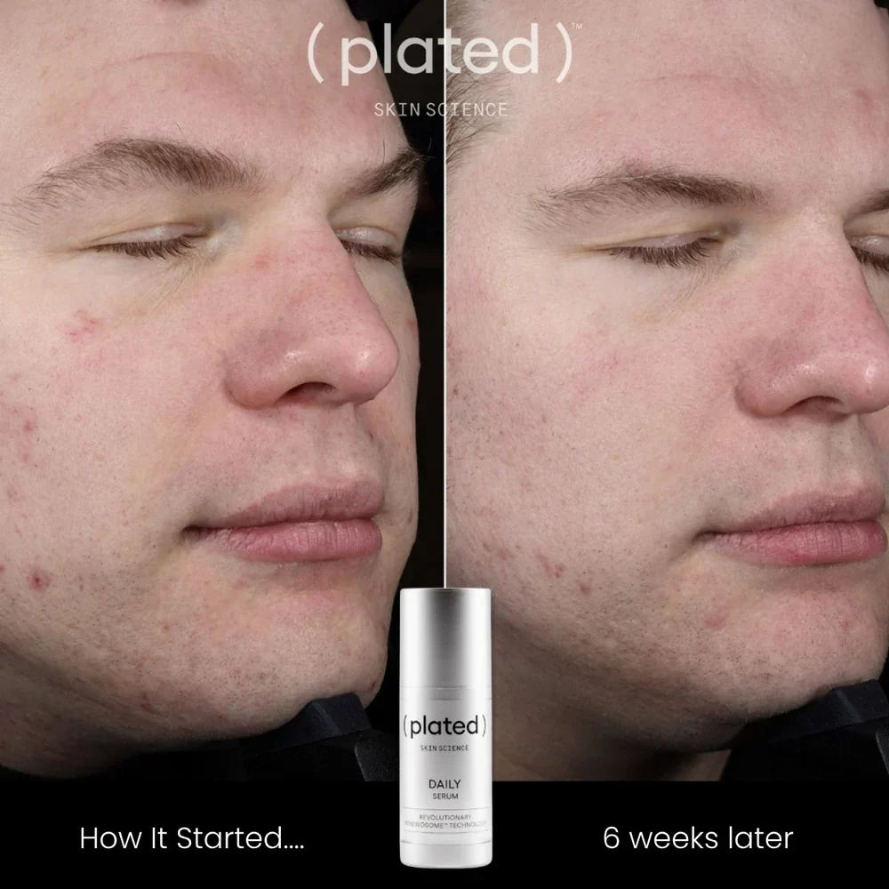 Daily Serum - 1 oz