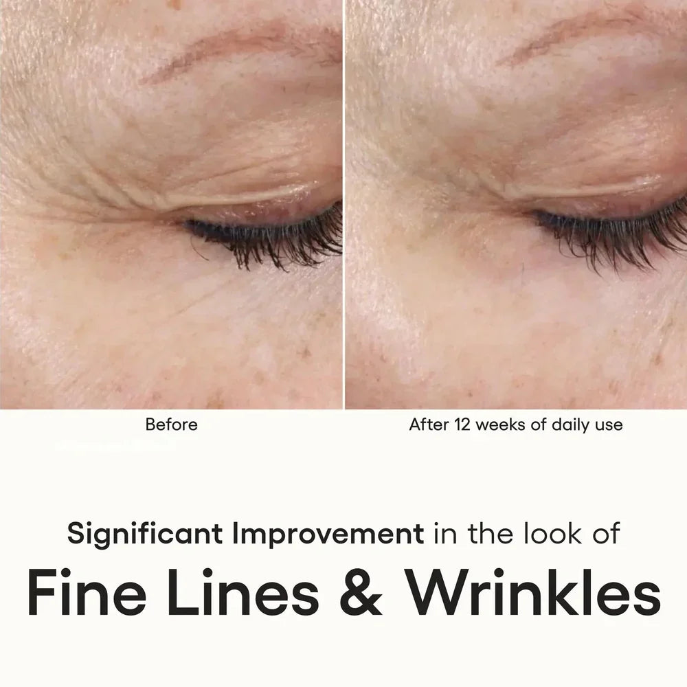 Intense Serum - 0.5 oz