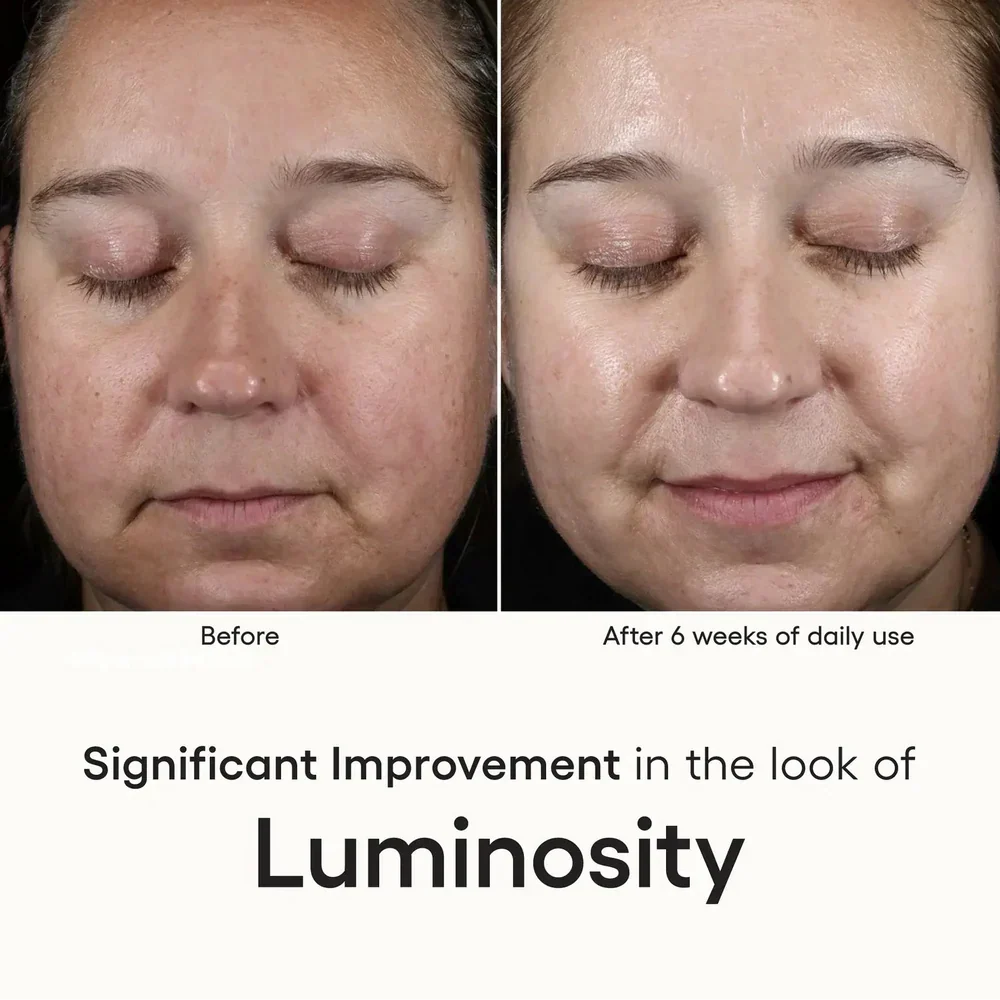 Intense Serum - 0.5 oz